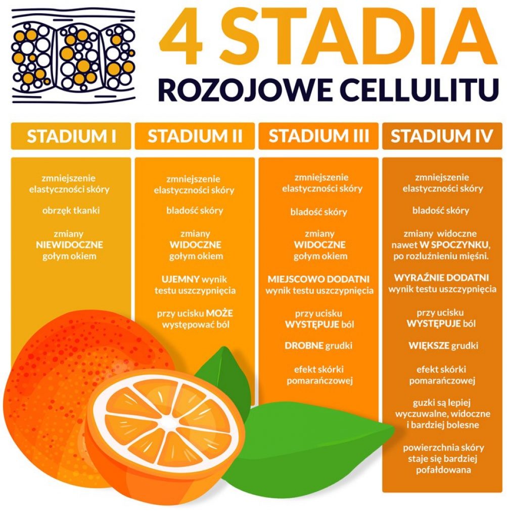 4 stadia rozwojowe cellulitu