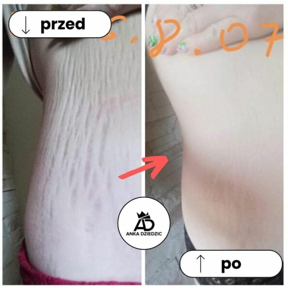 FitLab Olejek Na Rozstępy o Działaniu Antycellulitowym - obrazek 2