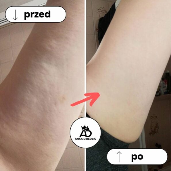 FitLab Olejek Na Rozstępy o Działaniu Antycellulitowym - obrazek 3