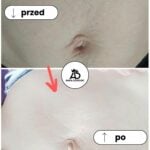 FitLab Olejek Na Rozstępy o Działaniu Antycellulitowym - obrazek 4